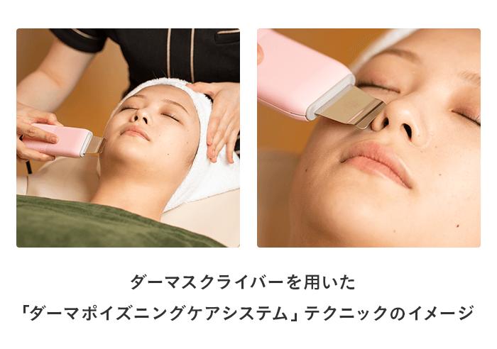 ダーマスクライバー施術イメージ