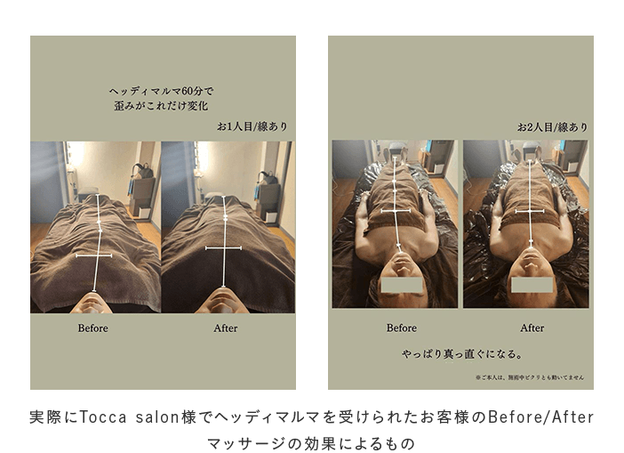 Tocca salon様でヘッディマルマを受けられたお客様のBefore/After-マッサージの効果によるもの